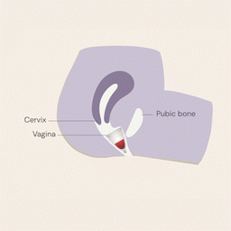 How to Use Image